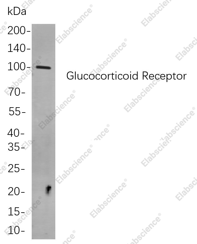 Recombinant Glucocorticoid Receptor Monoclonal Antibody - 1