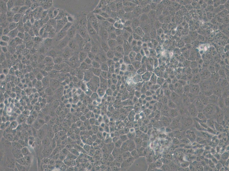 MKN74 Cell Complete Medium - 6