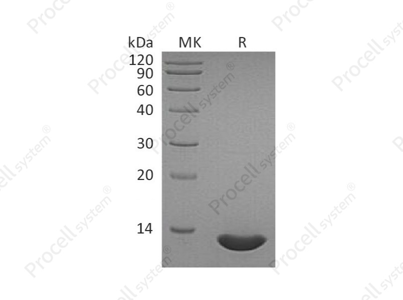 CCL2/MCP-1, Human, Recombinant