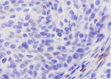 Recombinant Calponin 1 Monoclonal Antibody-searchlist-2