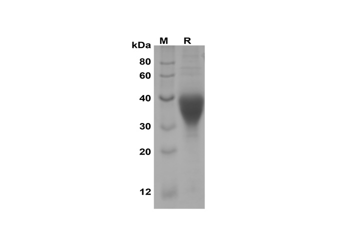 Recombinant Human LIF Protein(His Tag)-1