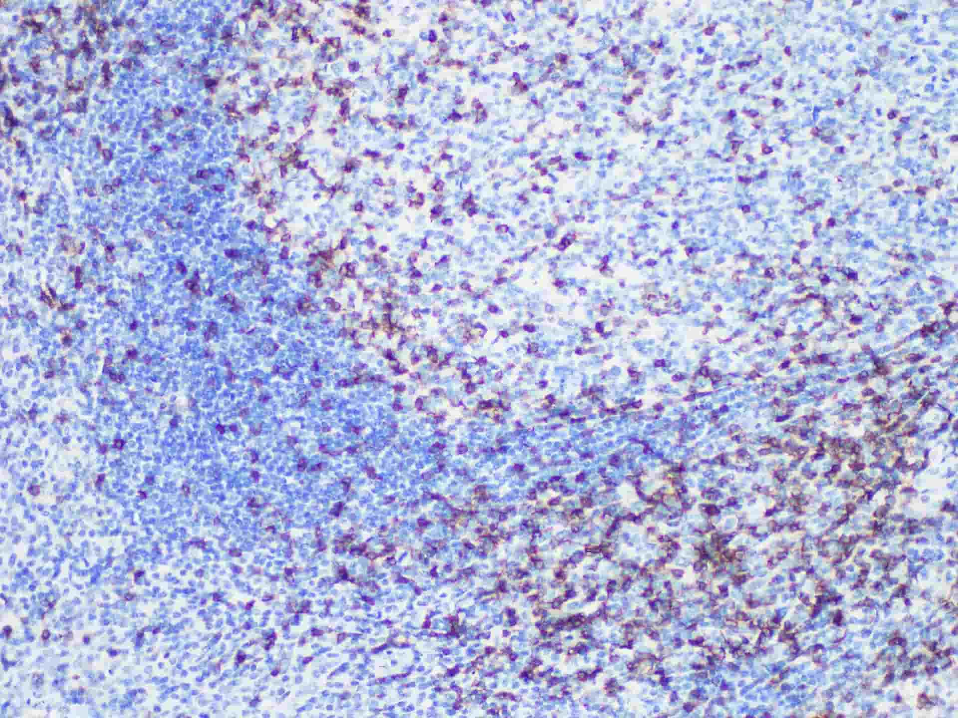CD45RO Monoclonal Antibody-searchlist-1