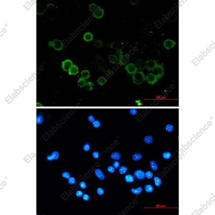 Recombinant E-Cadherin/CDH1/E-cad/CD324 Monoclonal Antibody - 4