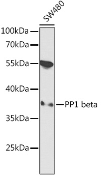 Western blot analysis of extracts of SW480 cells using PP1 beta Polyclonal Antibody at 1:1000 dilution.