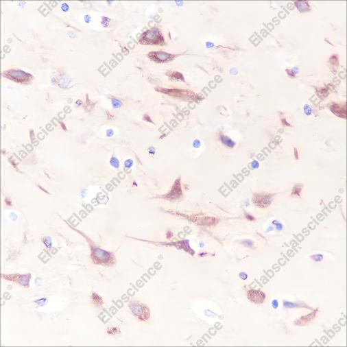 Recombinant BAP29 Monoclonal Antibody - 2