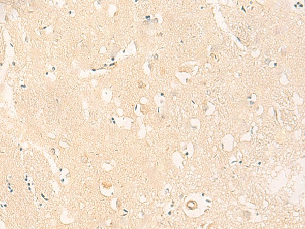 Immunohistochemistry of paraffin-embedded Human brain tissue  using IL37 Polyclonal Antibody at dilution of 1:50(?200)