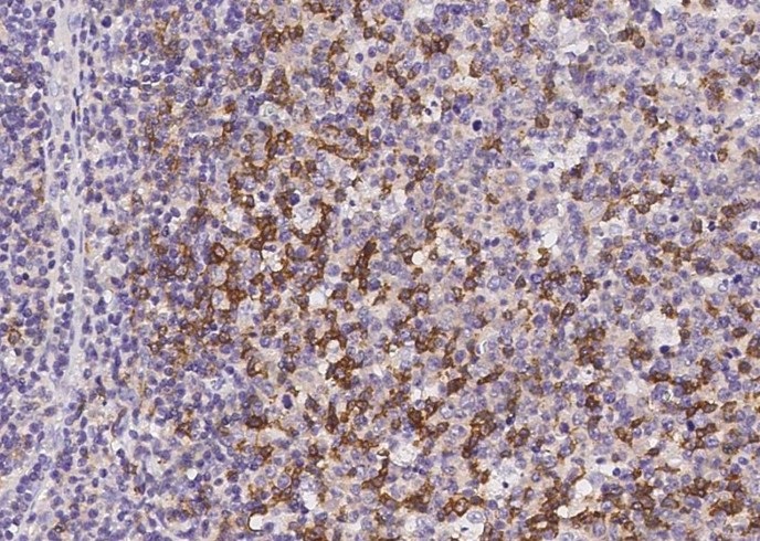 PD1/PDCD1/CD279 Monoclonal Antibody - 1