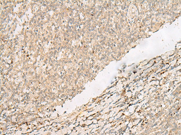 Immunohistochemistry of paraffin-embedded Human tonsil tissue  using PADI4 Polyclonal Antibody at dilution of 1:35(?200)