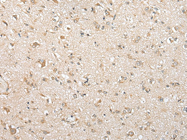 Immunohistochemistry of paraffin-embedded Human brain tissue  using NUDT10 Polyclonal Antibody at dilution of 1:70(?200)