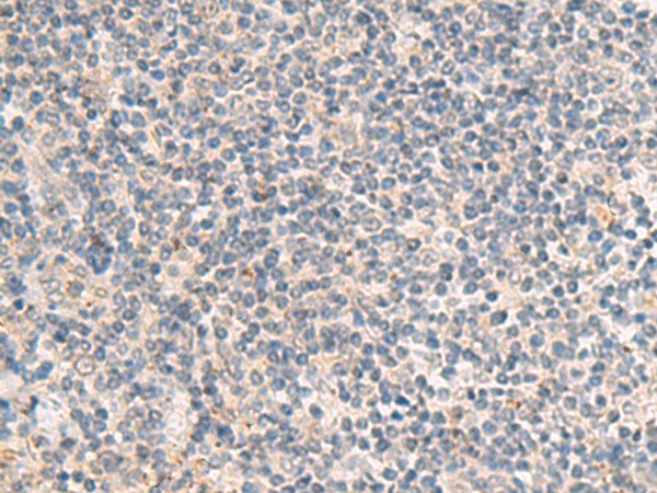 Immunohistochemistry of paraffin-embedded Human tonsil tissue  using IDUA Polyclonal Antibody at dilution of 1:35(?200)