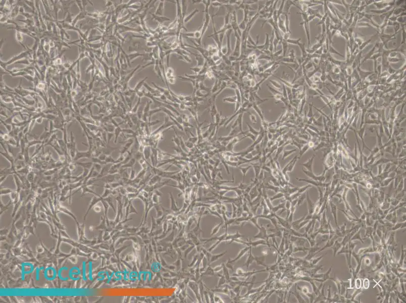 ES-2 Cell Complete Medium - 3