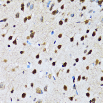 Immunohistochemistry of paraffin-embedded rat brain using CCAR2 Polyclonal Antibody at dilution of 1:100 (40x lens).Perform microwave antigen retrieval with 10 mM PBS buffer pH 7.2 before commencing with IHC staining protocol.