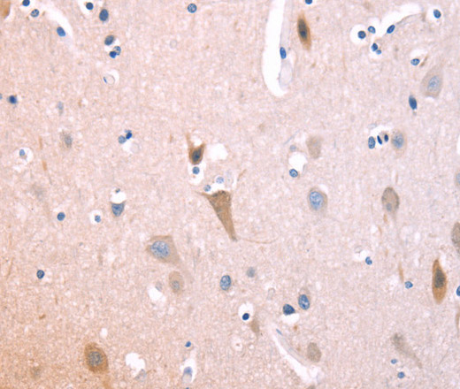 Immunohistochemistry of paraffin-embedded Human brain using ST2 Polyclonal Antibody at dilution of 1:70