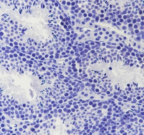 Recombinant DPP4/CD26 Monoclonal Antibody - small - 6