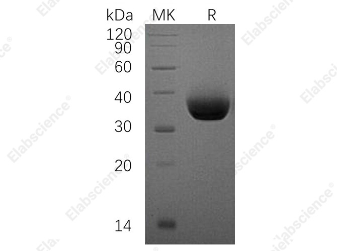 Recombinant Human PD-L1/B7-H1/CD274 Protein (His Tag) - 1