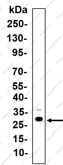 Recombinant STAR Monoclonal Antibody - 1