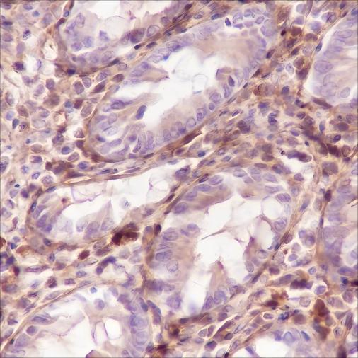 Recombinant Galectin-1 Monoclonal Antibody - small - 4