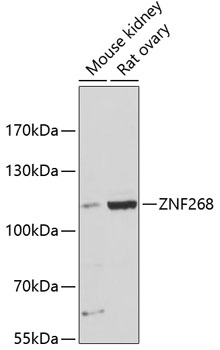 Western blot analysis of extracts of various cell lines using ZNF268 Polyclonal Antibody at dilution of 1:3000.