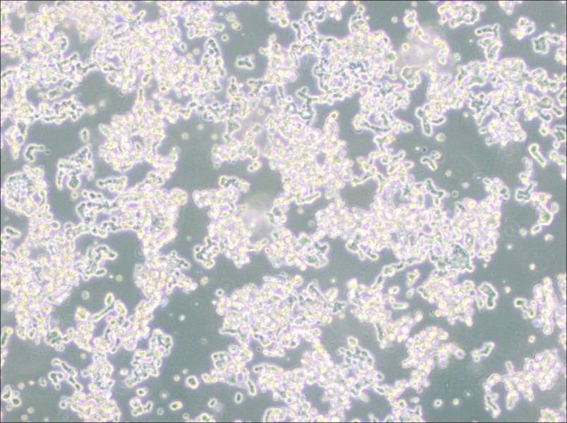 WERI-Rb-1 Cell Complete Medium - 3