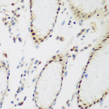 Immunohistochemistry of paraffin-embedded Human stomach using PPAN Polyclonal Antibody at dilution of 1:200 (40x lens).