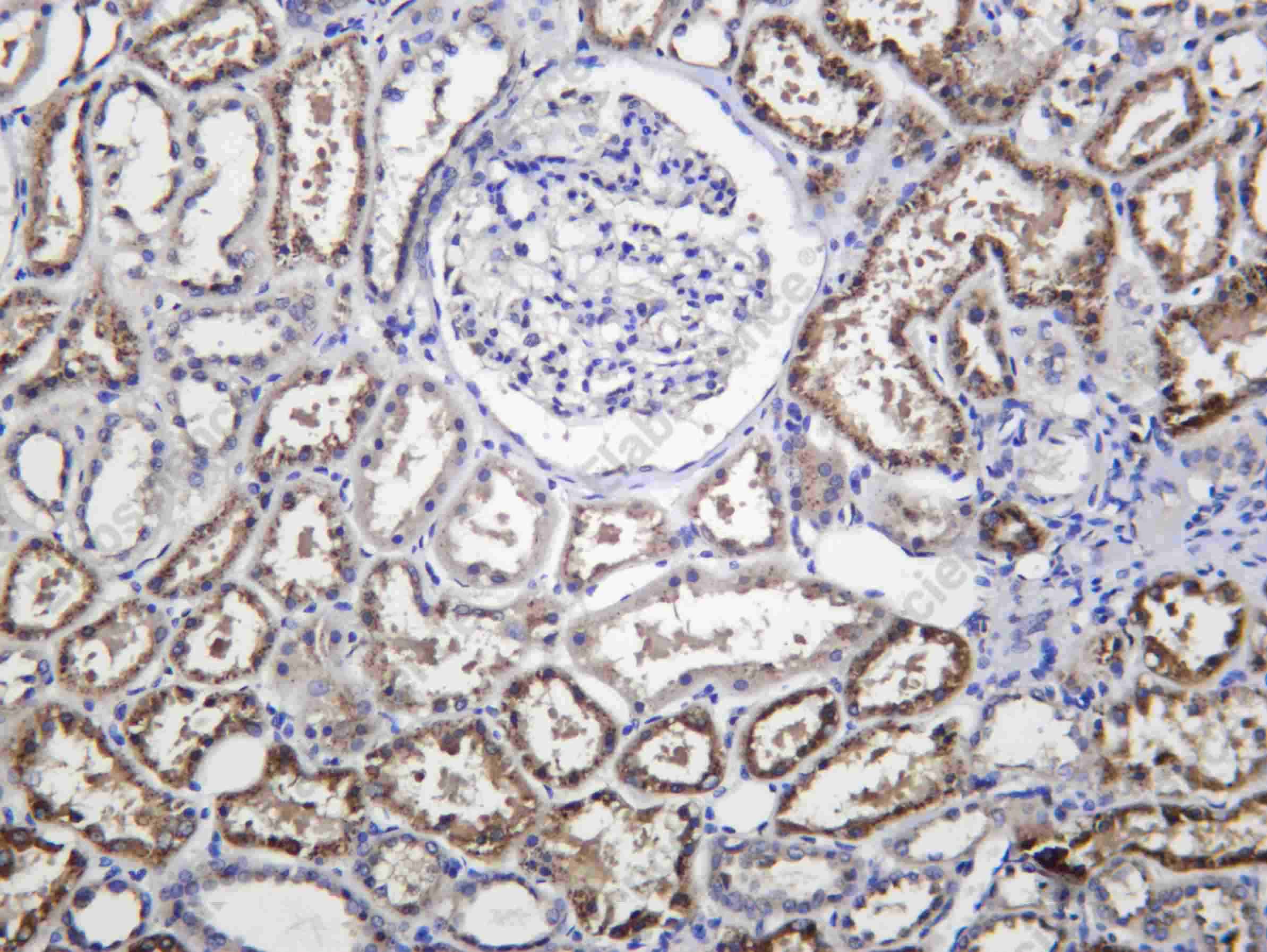 Recombinant SMIF Monoclonal Antibody - 1