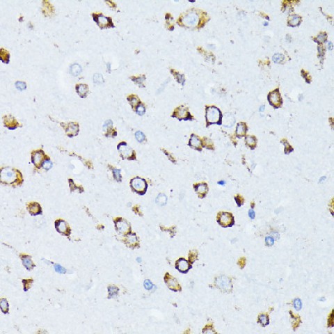 Immunohistochemistry of paraffin-embedded rat brain using BiP/GRP78 Polyclonal Antibody at dilution of 1:100 (40x lens).Perform microwave antigen retrieval with 10 mM PBS buffer pH 7.2 before commencing with IHC staining protocol.