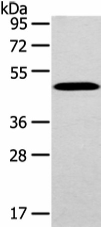 Western Blot analysis of Mouse brain tissue using WWOX Polyclonal Antibody at dilution of 1/200