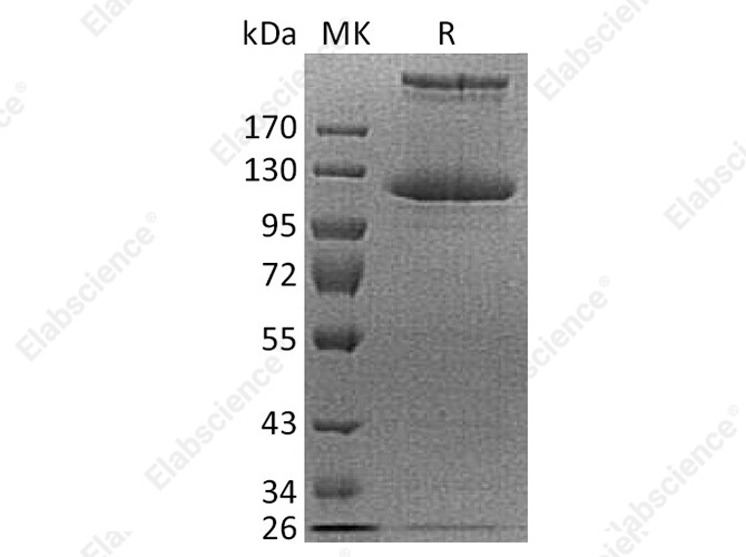Recombinant Human COL21A1 Protein (His Tag) - 1