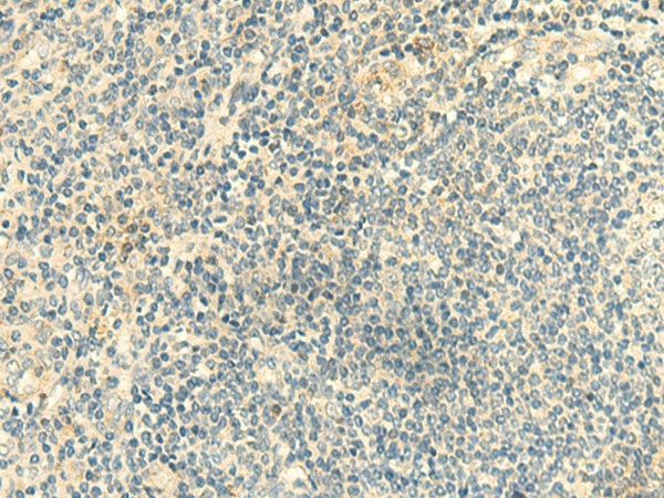 Immunohistochemistry of paraffin-embedded Human tonsil tissue  using CLEC10A Polyclonal Antibody at dilution of 1:50(?200)