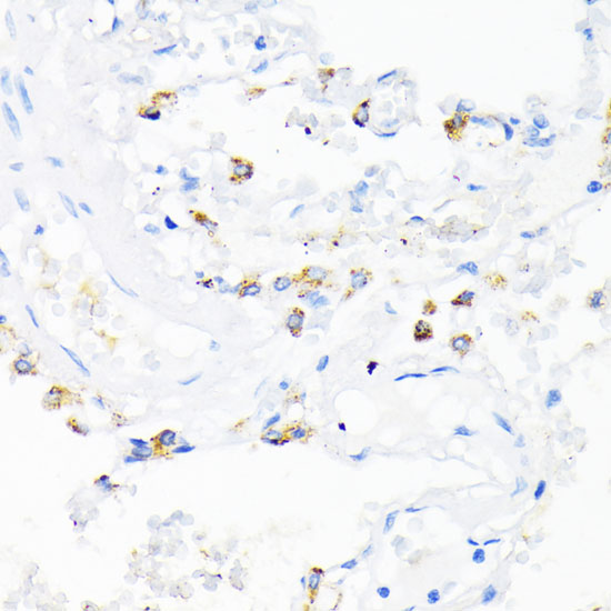 Immunohistochemistry of paraffin-embedded Human lung using CAMP Polyclonal Antibody at dilution of  1:200 (40x lens).