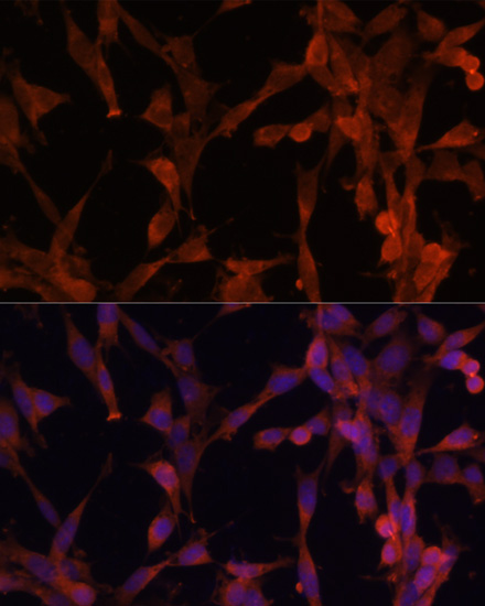 Immunofluorescence analysis of NIH-3T3 cells using UBE2G2 Polyclonal Antibody at dilution of  1:100. Blue: DAPI for nuclear staining.