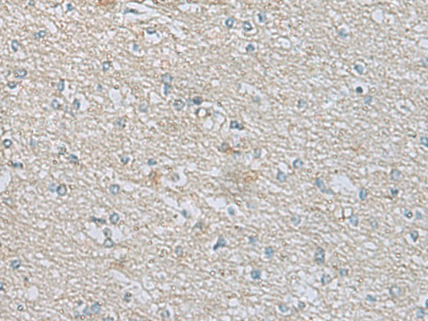 Immunohistochemistry of paraffin-embedded Human brain tissue  using CDH12 Polyclonal Antibody at dilution of 1:60(?200)