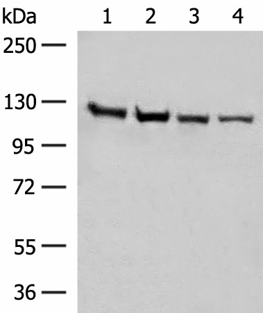 Western blot analysis of Human fetal brain tissue K562 cell Hela and A172 cell lysates  using IPO11 Polyclonal Antibody at dilution of 1:450