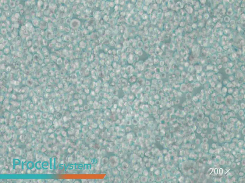 SU-DHL-2 Cell Complete Medium - 4