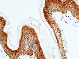 Recombinant IL20RA/IL-20RA Monoclonal Antibody-searchlist-1