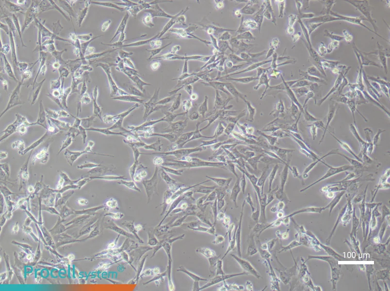Human Umbilical Cord Mesenchymal Stem (Primary cell immortalization) Cell Complete MediumHuman Umbilical Cord Mesenchymal Stem (Primary cell immortalization) Cell Complete Medium - 1