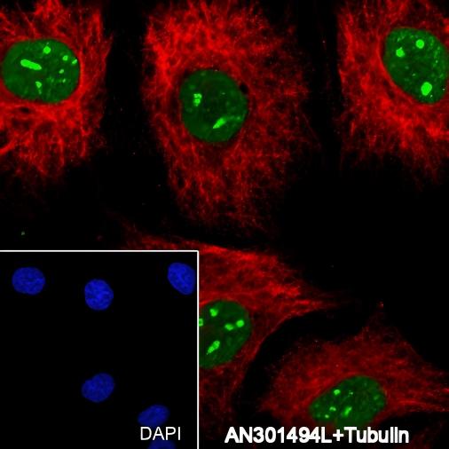 Recombinant Cleaved PARP1 p25 Monoclonal Antibody - small - 4