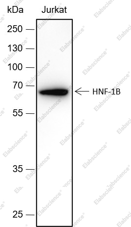 Recombinant HNF-1B Monoclonal Antibody - 1