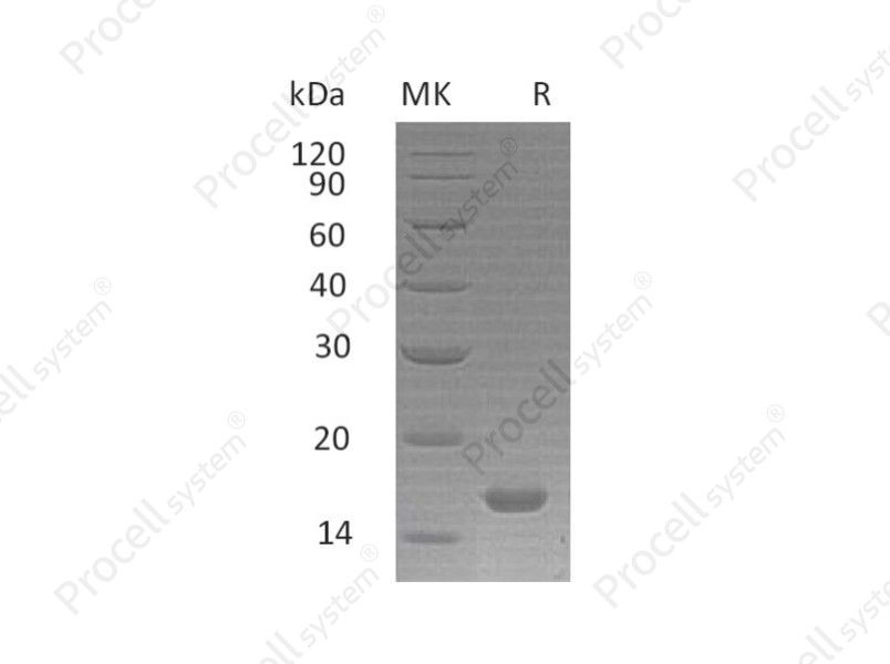 IL-21/Za11, Human, Recombinant