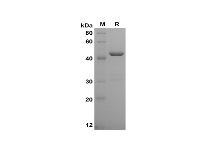Recombinant Human TNF-α Protein(Gst Tag)-1