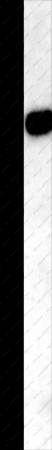 TNFRSF11B Polyclonal Antibody - 1
