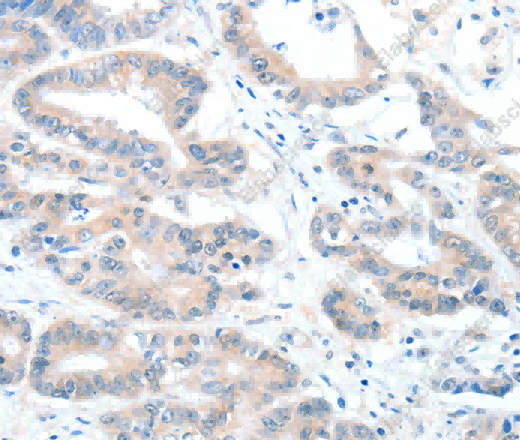 ALDH1A2 Polyclonal Antibody - 3