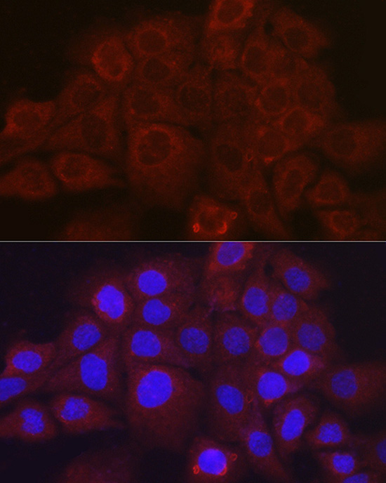 Immunofluorescence analysis of A431 cells using SSCA1/SerpinB3 Polyclonal Antibody at dilution of 1:100 (40x lens). Blue: DAPI for nuclear staining.