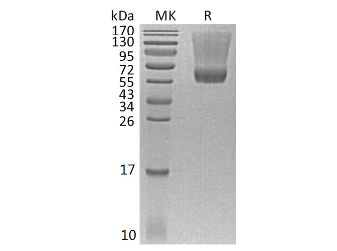 Recombinant Human Decorin Protein (Human Cells, His Tag)