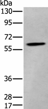 Western blot analysis of Human cerebrum tissue lysate  using ZKSCAN1 Polyclonal Antibody at dilution of 1:400