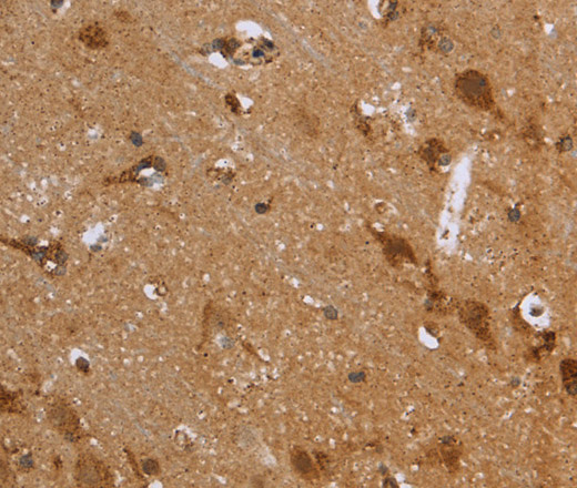 Immunohistochemistry of paraffin-embedded Human brain  using FH Polyclonal Antibody at dilution of 1:30