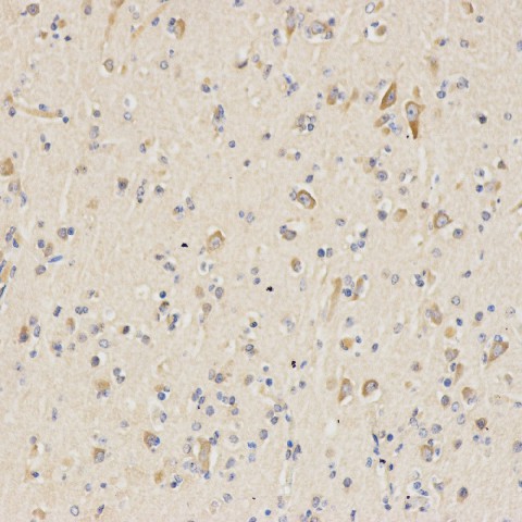 Immunohistochemistry analysis of paraffin-embedded human brain  using Tau Polyclonal Antibody at dilution of 1:100.