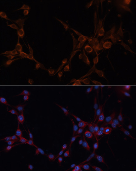 Immunofluorescence analysis of NIH/3T3 cells using ALDH6A1 Polyclonal Antibody at dilution of  1:100. Blue: DAPI for nuclear staining.