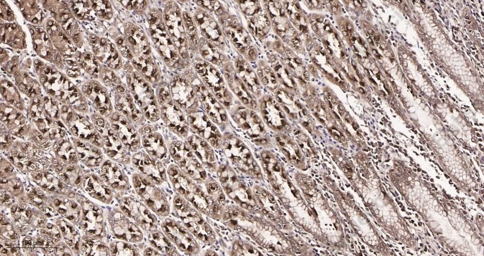 Recombinant IRF3 Monoclonal Antibody - 2
