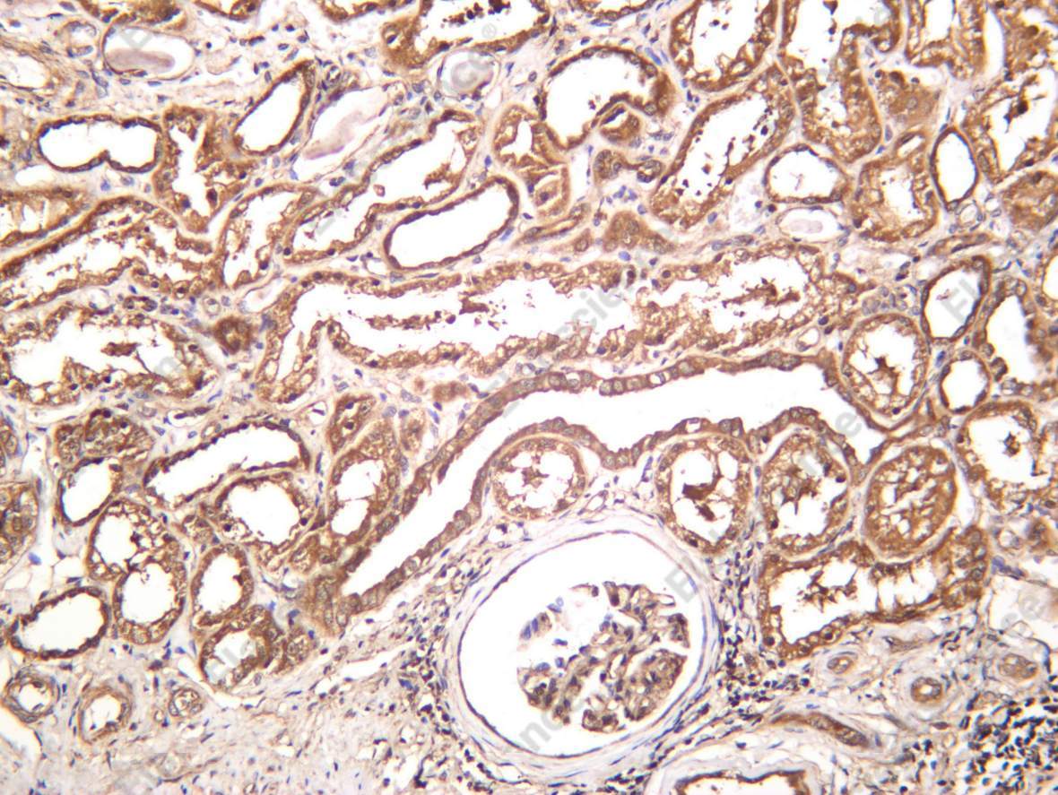 Recombinant IGFBP3 Monoclonal Antibody - 1